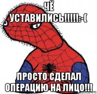 чё уставились!!!!!:-( просто сделал операцию на лицо!!!