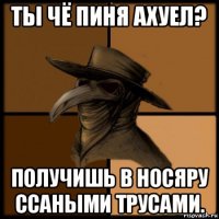 ты чё пиня ахуел? получишь в носяру ссаными трусами.