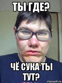 ты где? чё сука ты тут?