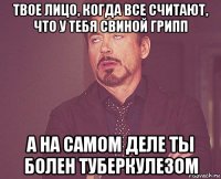 твое лицо, когда все считают, что у тебя свиной грипп а на самом деле ты болен туберкулезом