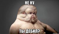 не ну ты дебил?