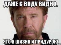 даже с виду видно, ято я шизик и придурок!