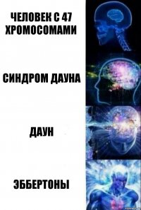 человек с 47 хромосомами Синдром дауна Даун Эббертоны