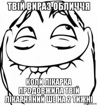 твій вираз обличчя коли лікарка продовжила твій лікарняний ше на 2 тижні