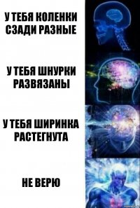 у тебя коленки сзади разные у тебя шнурки развязаны у тебя ширинка растегнута НЕ ВЕРЮ