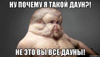 ну почему я такой даун?! не это вы все дауны!