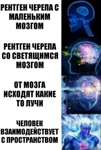 рентген черепа с маленьким мозгом рентген черепа со светящимся мозгом от мозга исходят какие то лучи человек взаимодействует с пространством