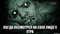  когда посмотрел на своё лицо с утра