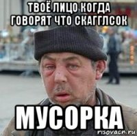 твоё лицо когда говорят что скагглсок мусорка