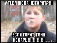 у тебя жопа не горит?!!! если горит, гони косарь!!!!!!!!!!!!!