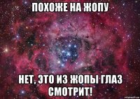 похоже на жопу нет, это из жопы глаз смотрит!