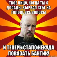 твоё лицо, когда ты с досады вырвал себе на голове все волосы и теперь стало некуда повязать бантик!