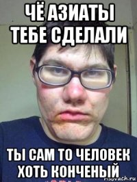 чё азиаты тебе сделали ты сам то человек хоть конченый