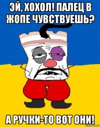 эй, хохол! палец в жопе чувствуешь? а ручки-то вот они!