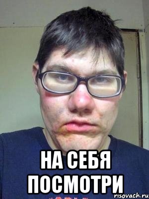  на себя посмотри, Мем красавчик