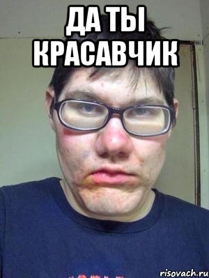 да ты красавчик , Мем красавчик