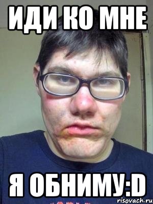 иди ко мне я обниму:d