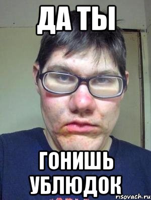 да ты гонишь ублюдок