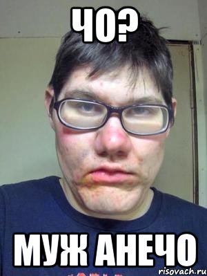 чо? муж анечо