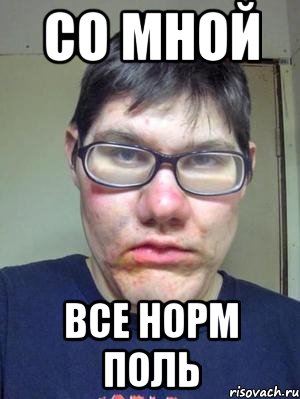 со мной все норм поль