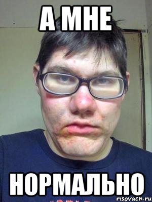 а мне нормально
