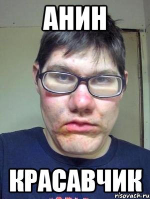 анин красавчик