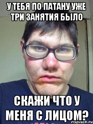 у тебя по патану уже три занятия было скажи что у меня с лицом?
