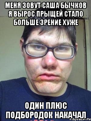 меня зовут саша бычков я вырос прыщей стало больше зрение хуже один плюс подбородок накачал