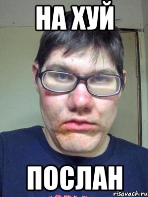 на хуй послан