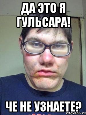 да это я гульсара! че не узнаете?