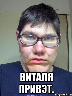  виталя привэт.