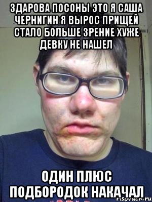 здарова посоны это я саша чернигин я вырос прищей стало больше зрение хуже девку не нашел один плюс подбородок накачал