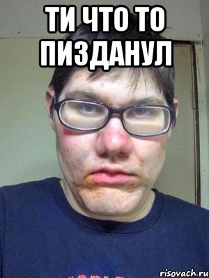 ти что то пизданул 