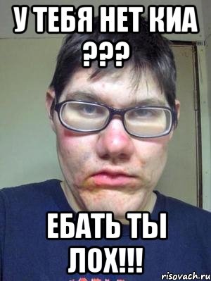 у тебя нет киа ??? ебать ты лох!!!