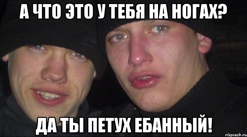 а что это у тебя на ногах? да ты петух ебанный!