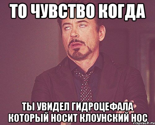 то чувство когда ты увидел гидроцефала который носит клоунский нос, Мем твое выражение лица