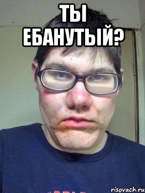 ты ебанутый? , Мем красавчик