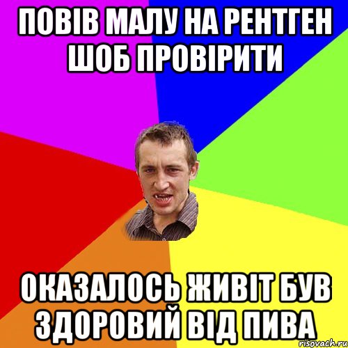 Повів малу на рентген шоб провірити оказалось живіт був здоровий від пива, Мем Чоткий паца