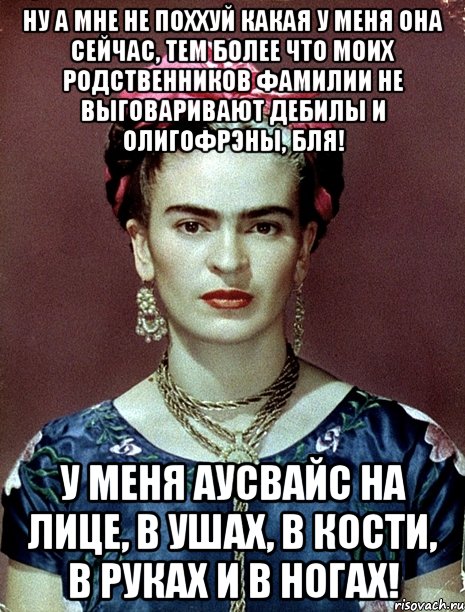 Ну а мне не поххуй какая у меня она сейчас, тем более что моих родственников фамилии не выговаривают дебилы и олигофрэны, бля! У меня аусвайс на лице, в ушах, в кости, в руках и в ногах!, Мем Magdalena Carmen Frieda Kahlo Ca