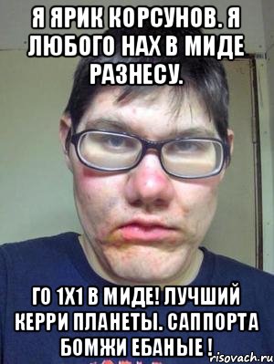я ярик корсунов. я любого нах в миде разнесу. го 1х1 в миде! лучший керри планеты. саппорта бомжи ебаные !