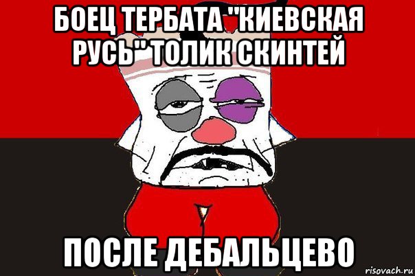 боец тербата "киевская русь" толик скинтей после дебальцево