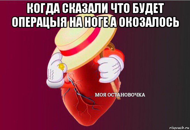 когда сказали что будет операцыя на ноге а окозалось , Мем   Моя остановочка