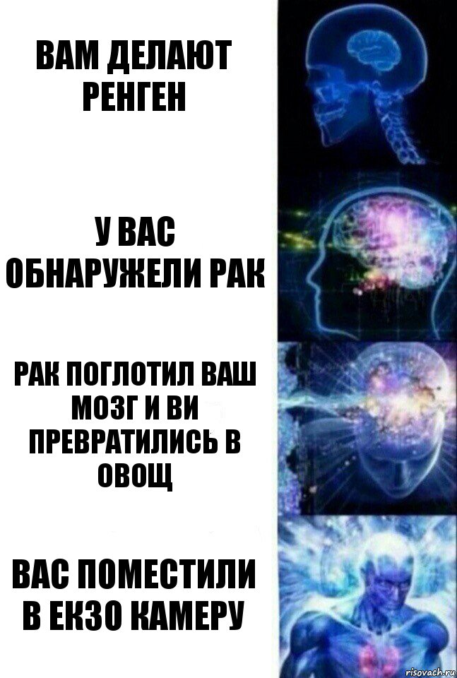 вам делают ренген у вас обнаружели рак рак поглотил ваш мозг и ви превратились в овощ вас поместили в екзо камеру, Комикс  Сверхразум