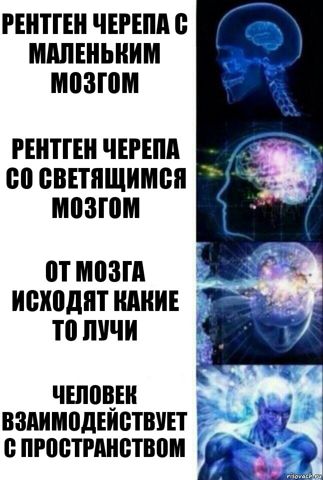 рентген черепа с маленьким мозгом рентген черепа со светящимся мозгом от мозга исходят какие то лучи человек взаимодействует с пространством, Комикс  Сверхразум