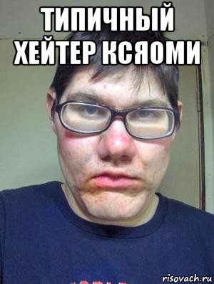 типичный хейтер ксяоми 