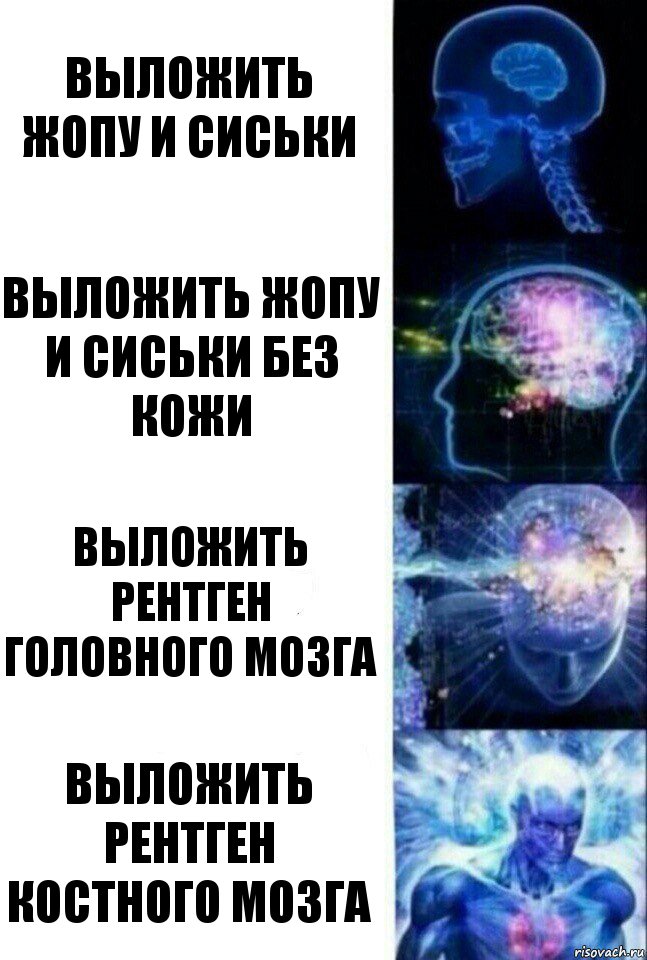 Выложить жопу и сиськи Выложить жопу и сиськи без кожи Выложить рентген головного мозга Выложить рентген костного мозга, Комикс  Сверхразум