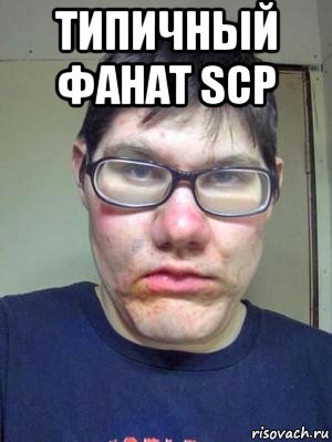 типичный фанат scp 